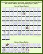 MUC6 (Mucin 6/Gastric Mucin) Recombinant Rabbit Monoclonal Antibody (MSVA-806R)