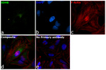 SDHB Monoclonal Antibody (21A11AE7)