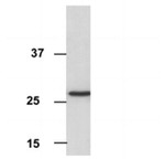 Porin Monoclonal Antibody (16G9E6BC4)