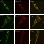 MTCO1 Antibody in Immunohistochemistry (IHC)