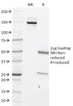 c-Myc Oncoprotein Monoclonal Antibody (MYC699)