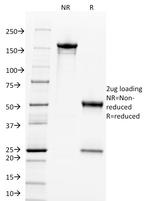 c-Myc Oncoprotein Monoclonal Antibody ([9E11])
