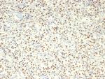 c-Myc Oncoprotein Recombinant Rabbit Monoclonal Antibody (MYC/7854R)