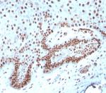 c-Myc Oncoprotein Antibody in Immunohistochemistry (Paraffin) (IHC (P))