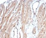 c-Myc Oncoprotein Antibody in Immunohistochemistry (Paraffin) (IHC (P))