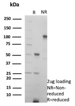 MYH7 Antibody in SDS-PAGE (SDS-PAGE)