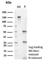 MYH7 Antibody in SDS-PAGE (SDS-PAGE)