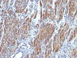 Smooth Muscle Myosin Heavy Chain (SM-MHC) Antibody in Immunohistochemistry (Paraffin) (IHC (P))