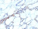 Smooth Muscle Myosin Heavy Chain (SM-MHC) Monoclonal Antibody (SPM201)