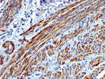 Smooth Muscle Myosin Heavy Chain (SM-MHC) Antibody in Immunohistochemistry (Paraffin) (IHC (P))