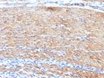 Smooth Muscle Myosin Heavy Chain (SM-MHC) Antibody in Immunohistochemistry (Paraffin) (IHC (P))
