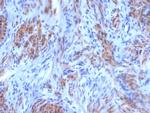 Smooth MuscleMyosin Heavy Chain (SM-MHC) (Leiomyosarcoma and Myoepithelial Cell Marker) Antibody in Immunohistochemistry (Paraffin) (IHC (P))