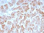 Smooth Muscle Myosin Heavy Chain (SM-MHC) (Leiomyosarcoma and Myoepithelial Cell Marker) Recombinant Rabbit Monoclonal Antibody (MYH11/8185R)