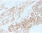 Smooth MuscleMyosin Heavy Chain (SM-MHC) (Leiomyosarcoma and Myoepithelial Cell Marker) Recombinant Rabbit Monoclonal Antibody (MYH11/4337R)