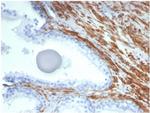 Smooth MuscleMyosin Heavy Chain (SM-MHC) (Leiomyosarcoma and Myoepithelial Cell Marker) Antibody in Immunohistochemistry (Paraffin) (IHC (P))