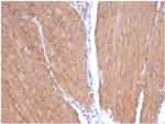 Smooth MuscleMyosin Heavy Chain (SM-MHC) (Leiomyosarcoma and Myoepithelial Cell Marker) Recombinant Rabbit Monoclonal Antibody (MYH11/7087R)
