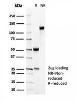 Smooth MuscleMyosin Heavy Chain (SM-MHC) (Leiomyosarcoma and Myoepithelial Cell Marker) Antibody in SDS-PAGE (SDS-PAGE)