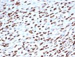 MyoD1 (Rhabdomyosarcoma Marker) Monoclonal Antibody (5.8A)