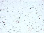 MyoD1 Recombinant Mouse Monoclonal Antibody (rMYOD1, 6911)