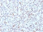 MyoD1 Recombinant Mouse Monoclonal Antibody (rMYD712)