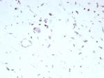 MyoD1 (Rhabdomyosarcoma Marker) Recombinant Rabbit Monoclonal Antibody (MYOD1/9405R)