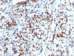 MyoD1 Antibody in Immunohistochemistry (Paraffin) (IHC (P))
