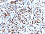 MyoD1 Recombinant Rabbit Monoclonal Antibody (MYOD1, 2075R)