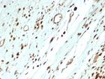 MyoD1 Recombinant Rabbit Monoclonal Antibody (MYOD1, 3418R)
