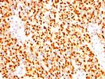 Myogenin/Myf-4 (Skeletal Muscle Marker) Monoclonal Antibody (SPM144)