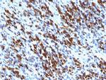 Myogenin/Myf-4 (Skeletal Muscle Marker) Monoclonal Antibody (MGN185, F5D)