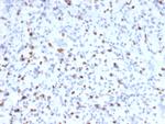 Myogenin/Myf-4 (Skeletal Muscle Marker) Monoclonal Antibody (MYOG/2660)