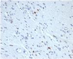Myogenin/Myf-4 (Skeletal Muscle Marker) Monoclonal Antibody (rMYOG/6297)