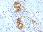 CD56/NCAM1/NKH1 (Neuronal Cell Marker) Antibody in Immunohistochemistry (Paraffin) (IHC (P))