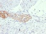 CD56/NCAM1/NKH1 (Neuronal Cell Marker) Antibody in Immunohistochemistry (Paraffin) (IHC (P))