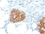 CD56/NCAM1/NKH1 (Neuronal Cell Marker) Antibody in Immunohistochemistry (Paraffin) (IHC (P))