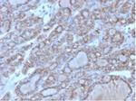CD56/NCAM1/NKH1 (Neuronal Cell Marker) Antibody in Immunohistochemistry (Paraffin) (IHC (P))
