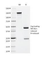 CD56/NCAM1/NKH1 (Neuronal Cell Marker) Antibody in SDS-PAGE (SDS-PAGE)