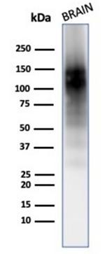 CD56/NCAM1/NKH1 (Neuronal Cell Marker) Antibody in Western Blot (WB)