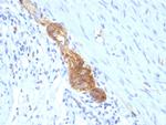 CD56/NCAM1 (Neuronal Cell Marker) Antibody in Immunohistochemistry (Paraffin) (IHC (P))