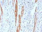 CD56/NCAM1/NKH1 (Neuronal Cell Marker) Antibody in Immunohistochemistry (Paraffin) (IHC (P))