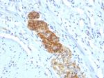 CD56/NCAM1/NKH1 Antibody in Immunohistochemistry (Paraffin) (IHC (P))