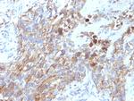CD56/NCAM1/NKH1 Monoclonal Antibody (NCAM1, 795)