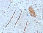 CD56/NCAM1/NKH1 (Neuronal Cell Marker) Antibody in Immunohistochemistry (Paraffin) (IHC (P))