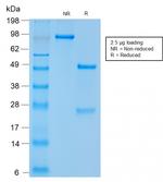 CD56/NCAM1/NKH1 Antibody in SDS-PAGE (SDS-PAGE)