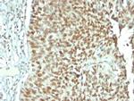 Nucleolin Antibody in Immunohistochemistry (Paraffin) (IHC (P))