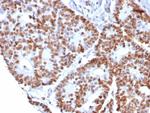 Nucleolin (Marker of Human Cells) Recombinant Rabbit Monoclonal Antibody (NCL/8068R)