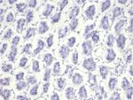 Nucleolin (Marker of Human Cells) Recombinant Rabbit Monoclonal Antibody (NCL/7014R)