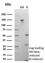 ATM/ATM serine/threonine kinase Antibody in SDS-PAGE (SDS-PAGE)