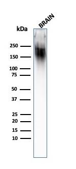 Neurofilament (NF-H) (Neuronal Marker) Antibody in Western Blot (WB)