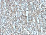 Neurofilament Recombinant Mouse Monoclonal Antibody (rNF421)